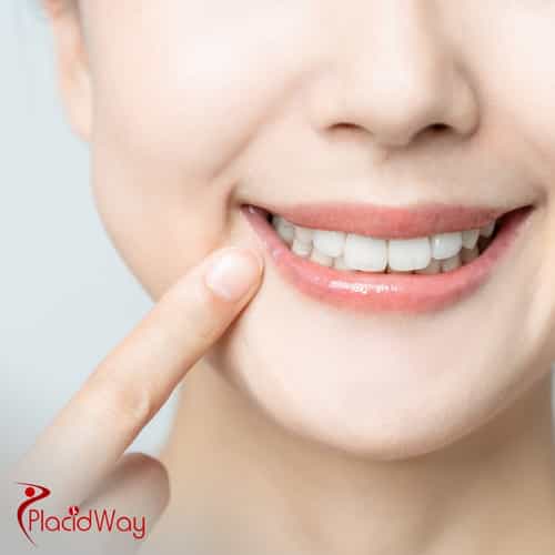 All-on-4 Dental Implants Cost in Thailand: Why Patients Choose Bangkok and Phuket